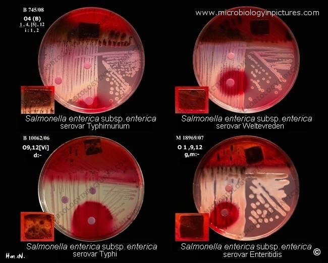 Salmonella enterica serovars salmonella enterica serovars (serotypes)